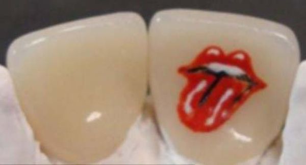 tatuaggi sui denti: rolling-stone